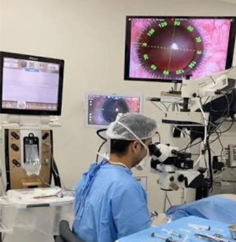 Médico sentado em um centro cirúrgico, realizando uma cirurgia de catarata, utilizando um equipamento chamado Sistema Verion, utilizado para realização de cirurgias com implantes de lentes intra-oculares.